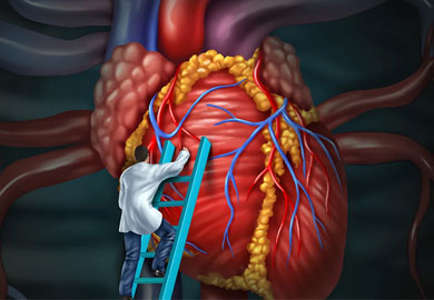 Aortic Surgery