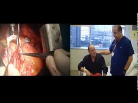 Çalışan Kalpte Bypass Ameliyatı – Op.Dr. Mahmut Akyıldız