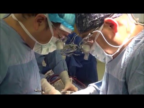Koltuk Altından Mitral Kapak Ameliyatı – Op.Dr. Mahmut Akyıldız