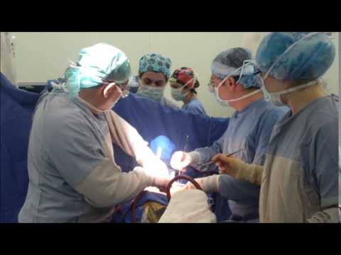 Koltuk Altından Çift Kapak Ameliyatı- (Biyoprotez)