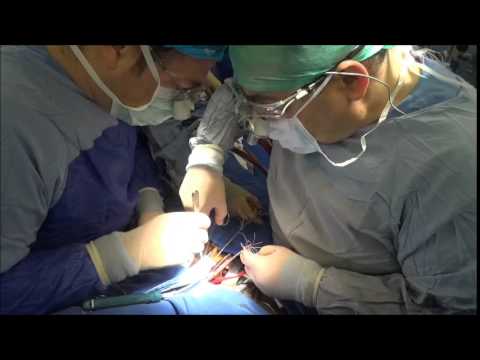 Mahmut Akyıldız – Koltuk Altı Aort Kapak Ameliyatı