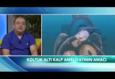 Op. Dr. Mahmut AKYILDIZ – EuroStar ( Doktorum Yanımda )